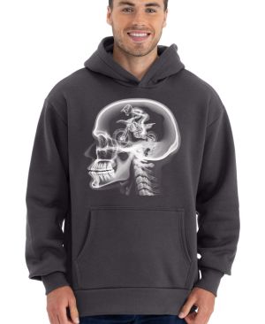 ENDURO v hlavě, rentgen kedlubny