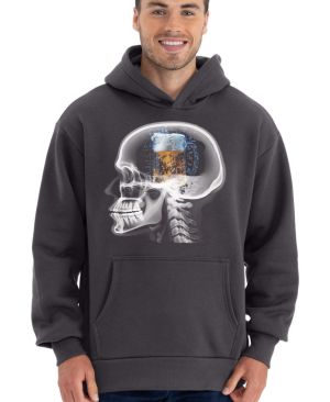 Pivo, v kedlubně, RTG snímek hlavy